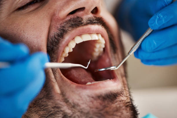 Tooth Infection Emergency Dentist in PA